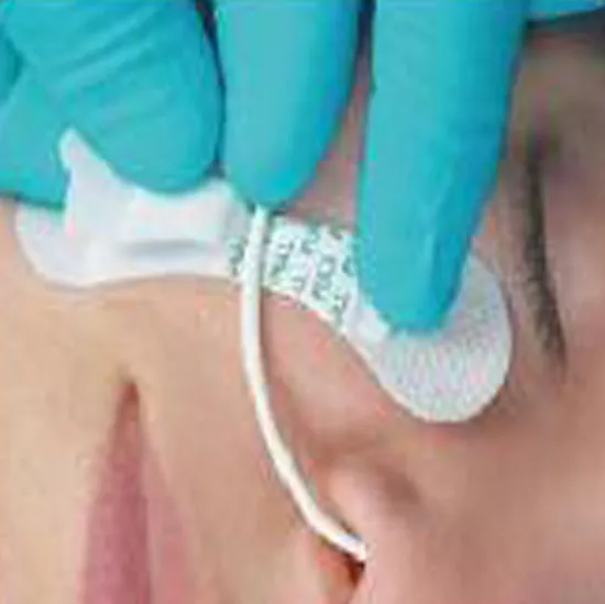 Dispositivo de fijación de catéter médico para sonda de alimentación nasogástrica estéril